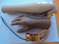 Above Elbow Prosthesis Kit